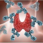 autoimmune diseases - Shutterstock