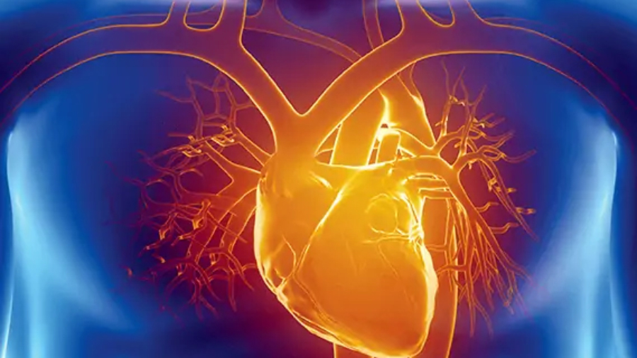 cardiac issues